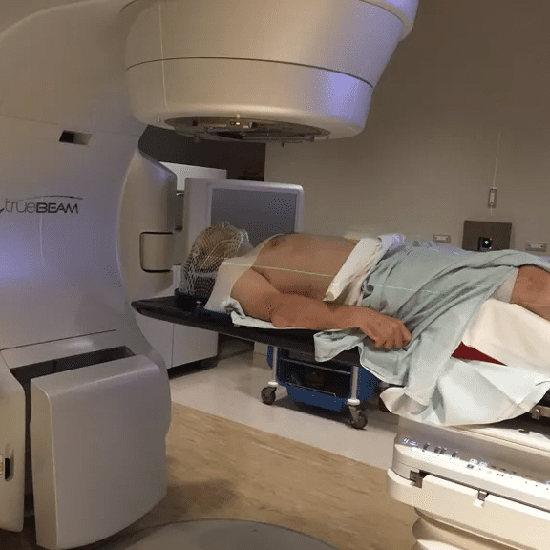 Stereotactic body radiation therapy (SBRT)